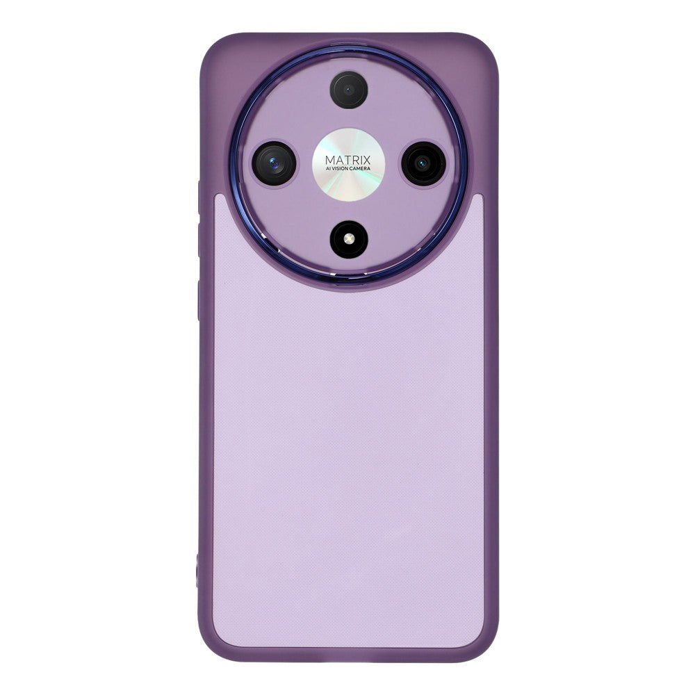 For Honor X9b 5G / X70 5G Case Electroplated Camera Frame TPU Phone Cover